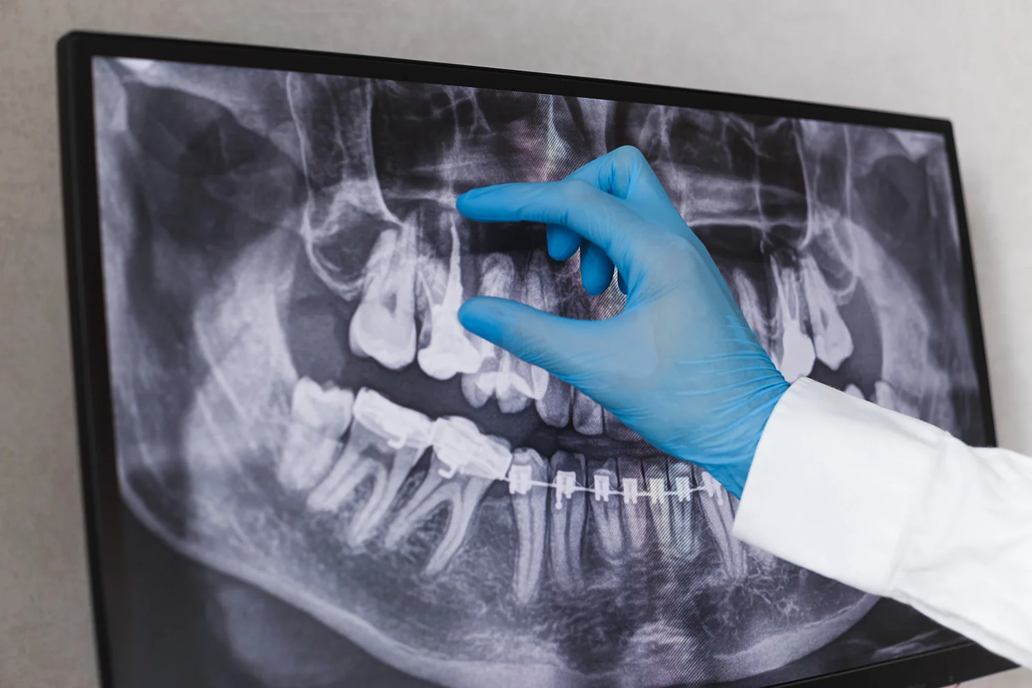 endodoncias
